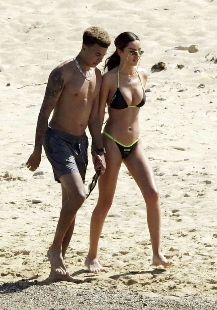 Dele Alli korkuttu! 25