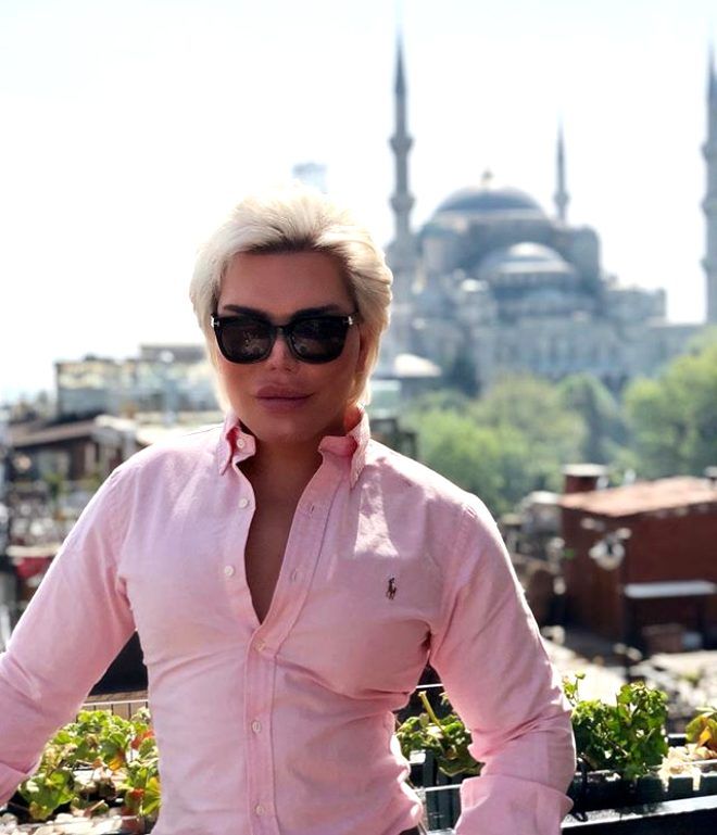 70. kez bıçak altına yatan "Ken Bebek"in son hali! 2