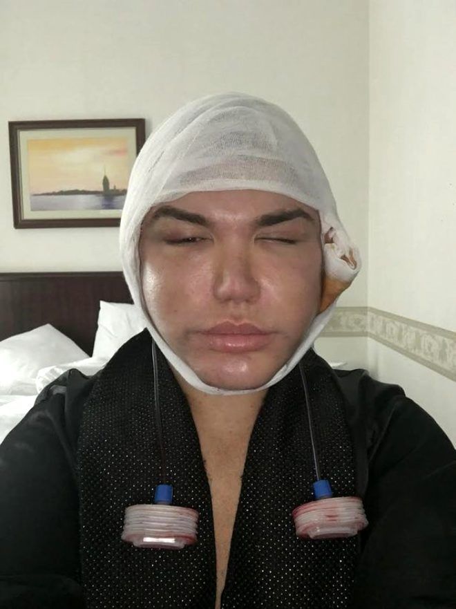 70. kez bıçak altına yatan "Ken Bebek"in son hali! 7