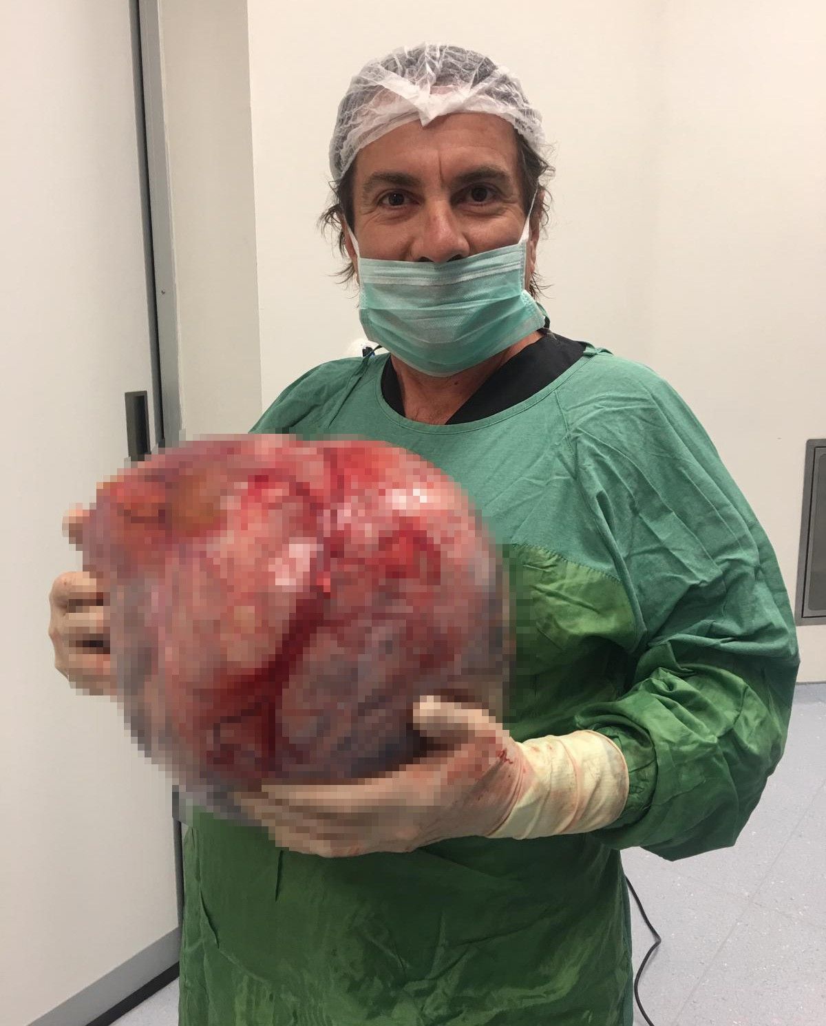 Karnından çıktı: Tam 12 kilo! 4