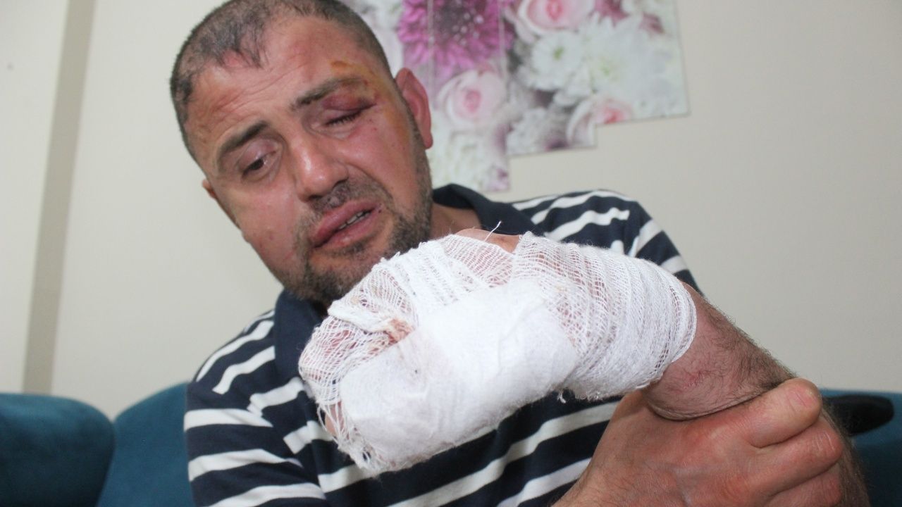 Irak gazisini öldüresiye dövdüler! 9