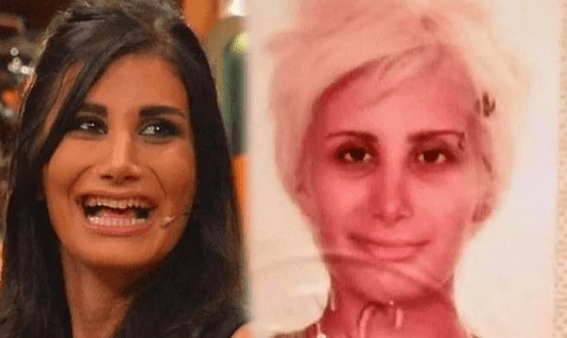 Estetik operasyonlarıyla bambaşka birine dönüştüler! 11