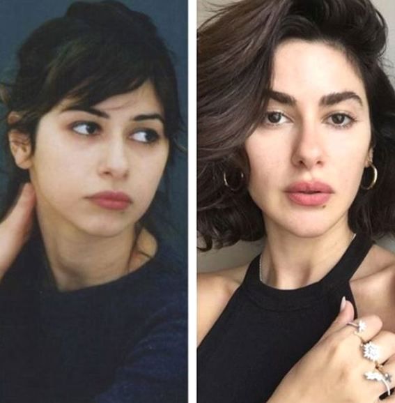 Estetik operasyonlarıyla bambaşka birine dönüştüler! 17