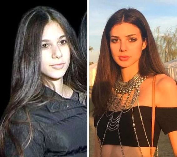 Estetik operasyonlarıyla bambaşka birine dönüştüler! 22