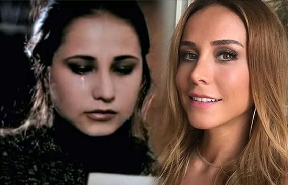 Estetik operasyonlarıyla bambaşka birine dönüştüler! 29