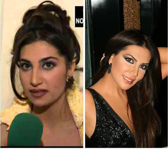 Estetik operasyonlarıyla bambaşka birine dönüştüler! 5