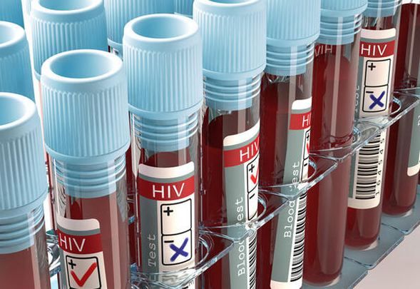 Dudağınızda bu yara varsa 'HIV' olabilirsiniz! 4