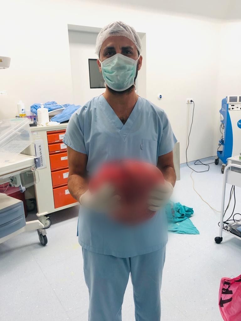 Yıllarca karnında onunla yaşadı! 3