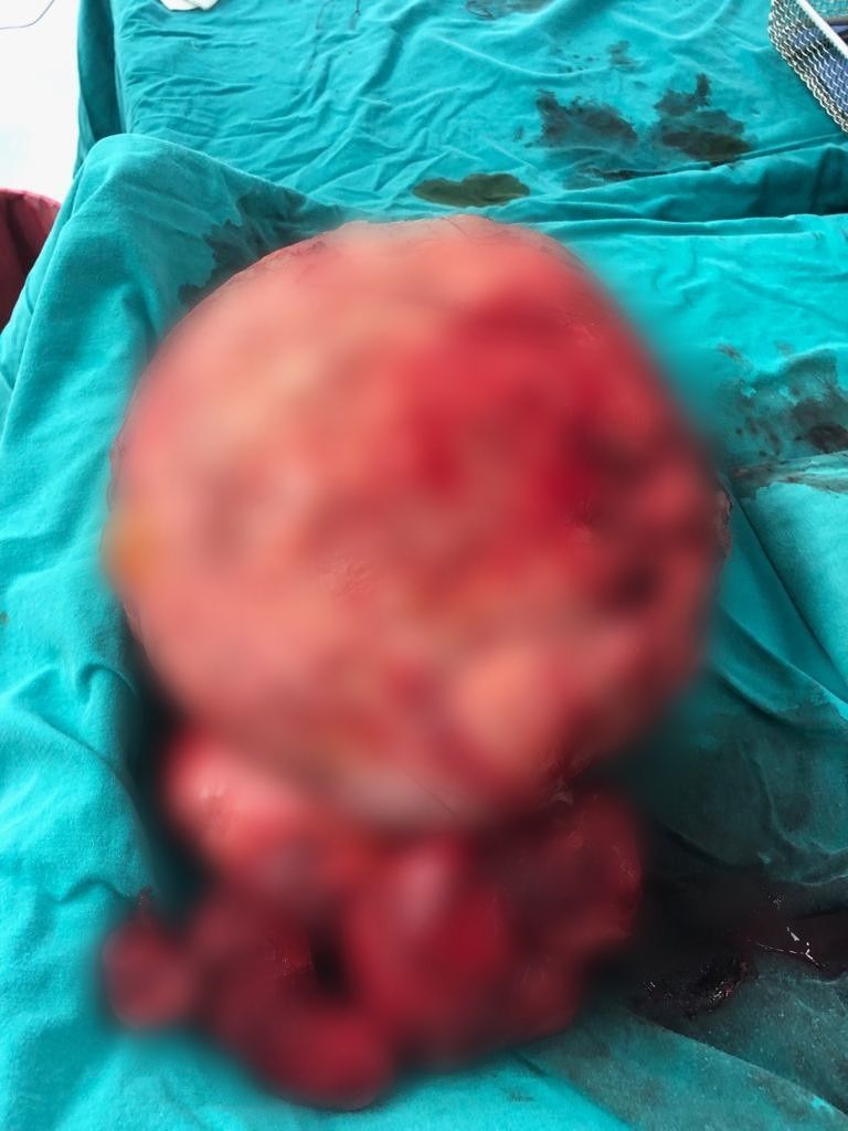 Yıllarca karnında onunla yaşadı! 4