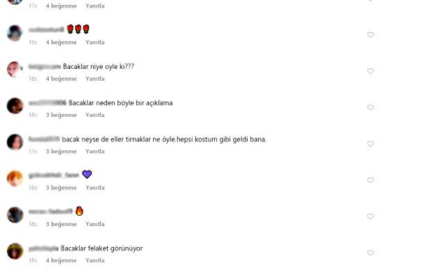 Bacaklarının görüntüsü olay oldu! 3