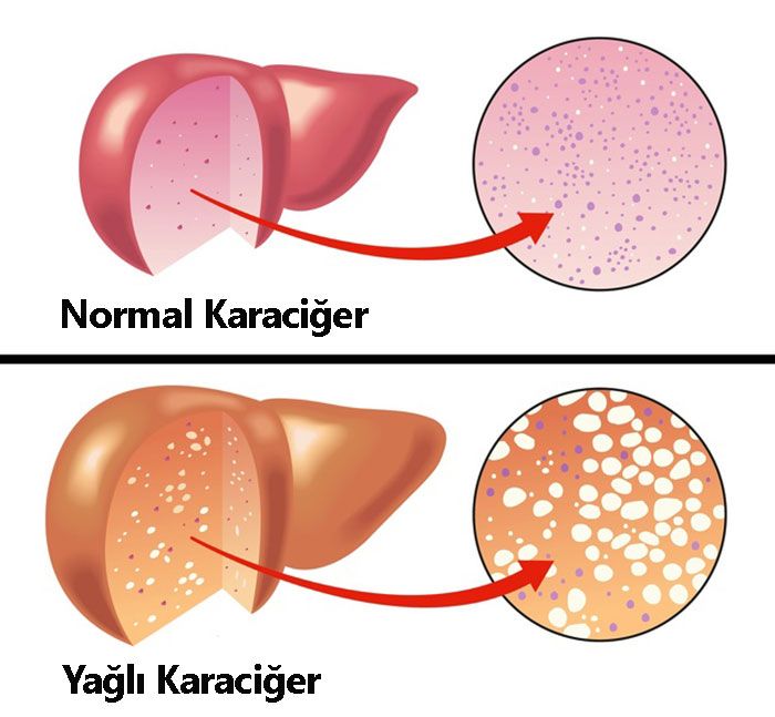 Protein eksikliği çekildiğini gösteren durumlar! 5