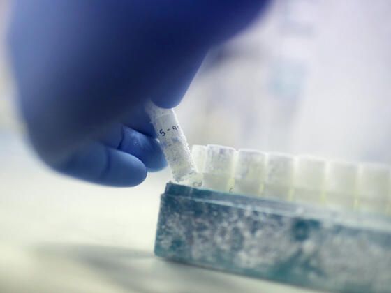 Korkunç gerçek DNA testinde ortaya çıktı! 12