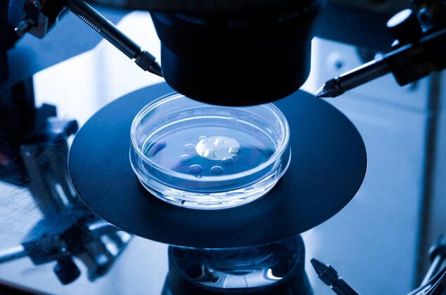 Korkunç gerçek DNA testinde ortaya çıktı! 2