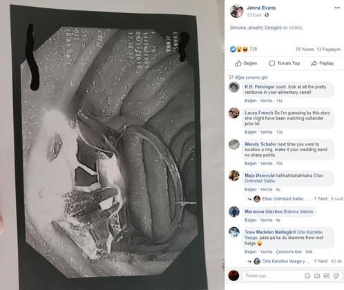 Gece rüyasında gördü, ertesi gün ameliyata girdi! 6