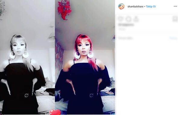 Sırada beklerken göğsünü ısırdı! 8