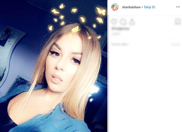 Sırada beklerken göğsünü ısırdı! 11