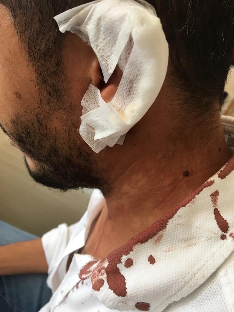 Öğrencilerinin önünde bıçakladılar! 3