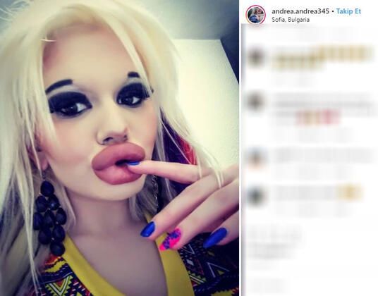 Dudağını bu hale getirmek için servet harcadı! 13
