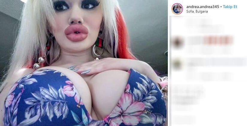 Dudağını bu hale getirmek için servet harcadı! 15