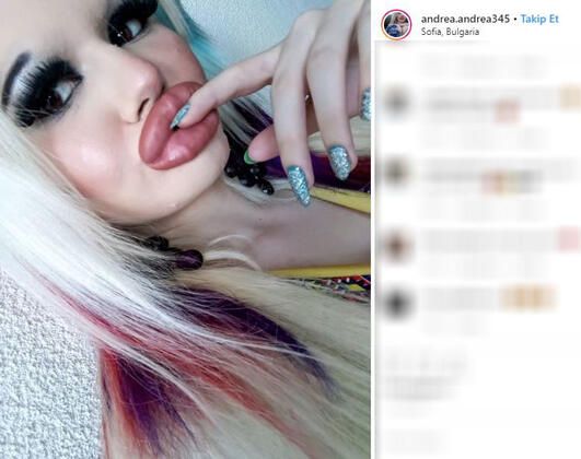 Dudağını bu hale getirmek için servet harcadı! 18