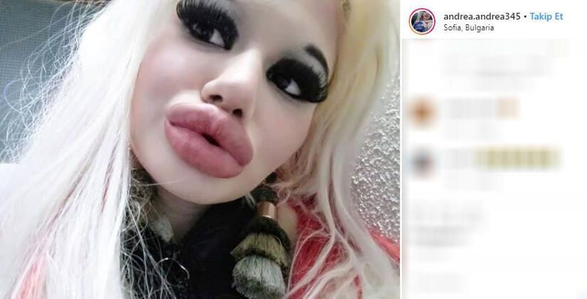 Dudağını bu hale getirmek için servet harcadı! 21