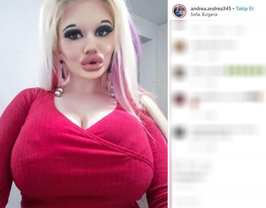 Dudağını bu hale getirmek için servet harcadı! 10