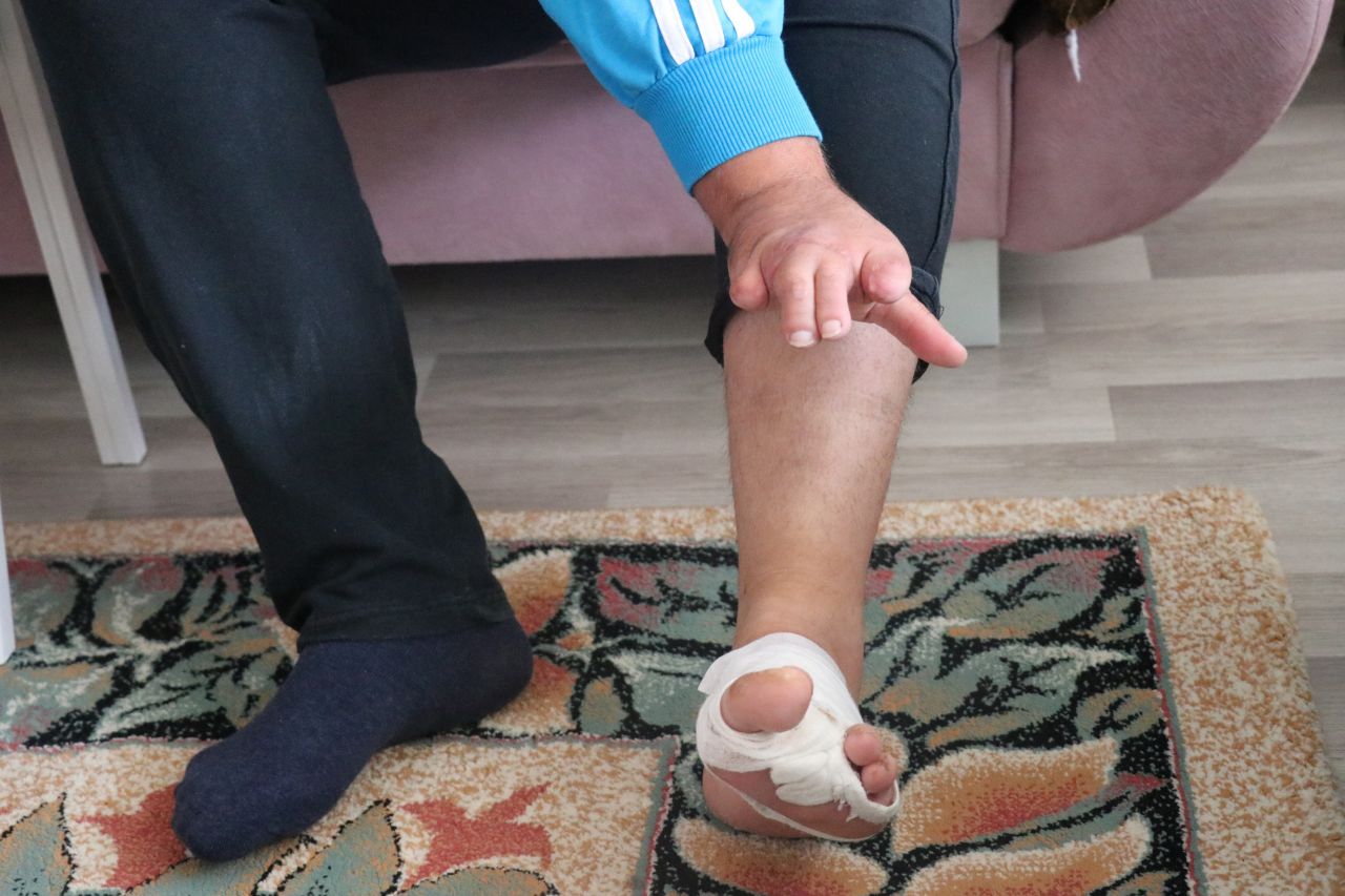 Ayak parmakları eline dikildi! 5