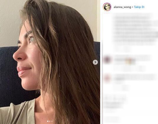 20 yaşında yatağa uzandı ve 8 ay uyanmadı! 3