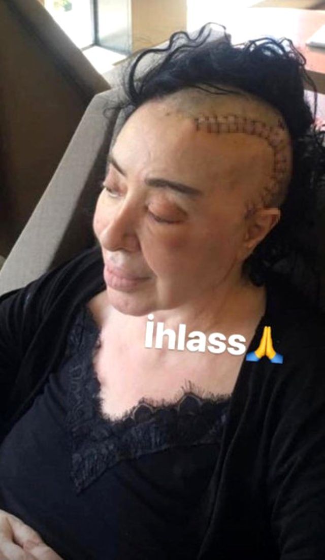 Son haliyle sevenlerini korkuttu! 4