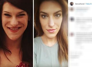 Uzuvları bir anda büyümeye başladı! 11