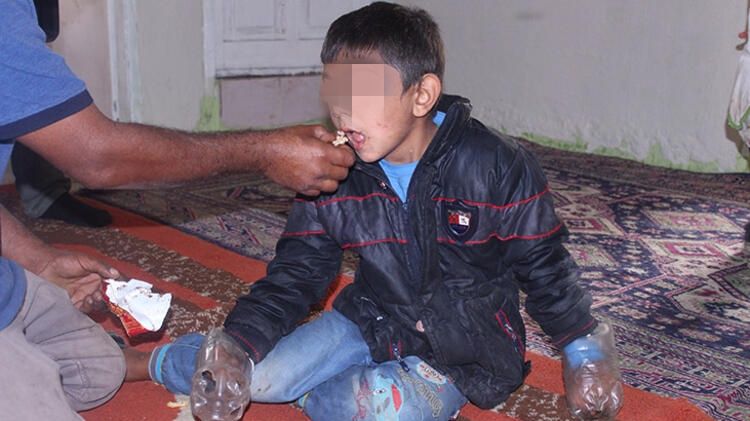Akılalmaz hastalık! Ailesi eline pet şişe takıyor... 4