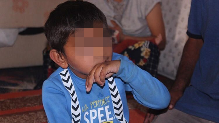 Akılalmaz hastalık! Ailesi eline pet şişe takıyor... 6