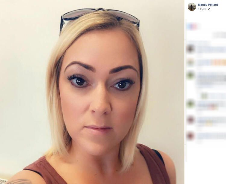 Burnundaki küçücük nokta hayatını kararttı! 17