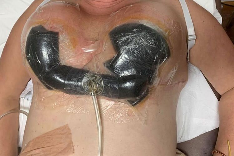 Poposunu kaldırtmak istedi, göğüslerini kaybetti! 4