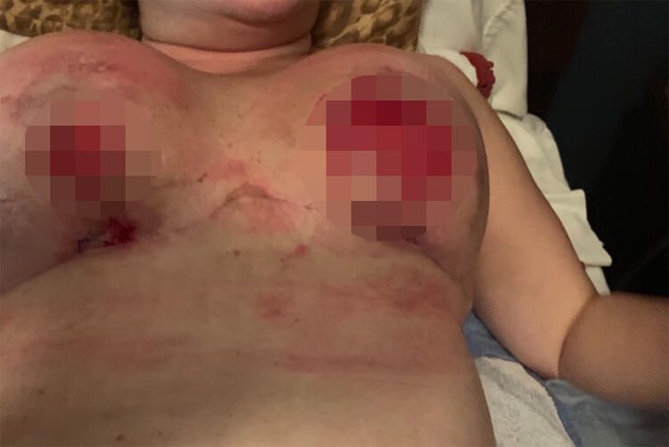 Poposunu kaldırtmak istedi, göğüslerini kaybetti! 6