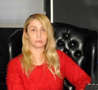 Güzellik uğruna alt dudağını kaybetti! Kötü haber geldi... 14