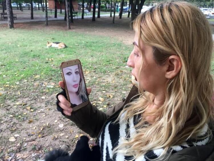 Güzellik uğruna alt dudağını kaybetti! Kötü haber geldi... 11