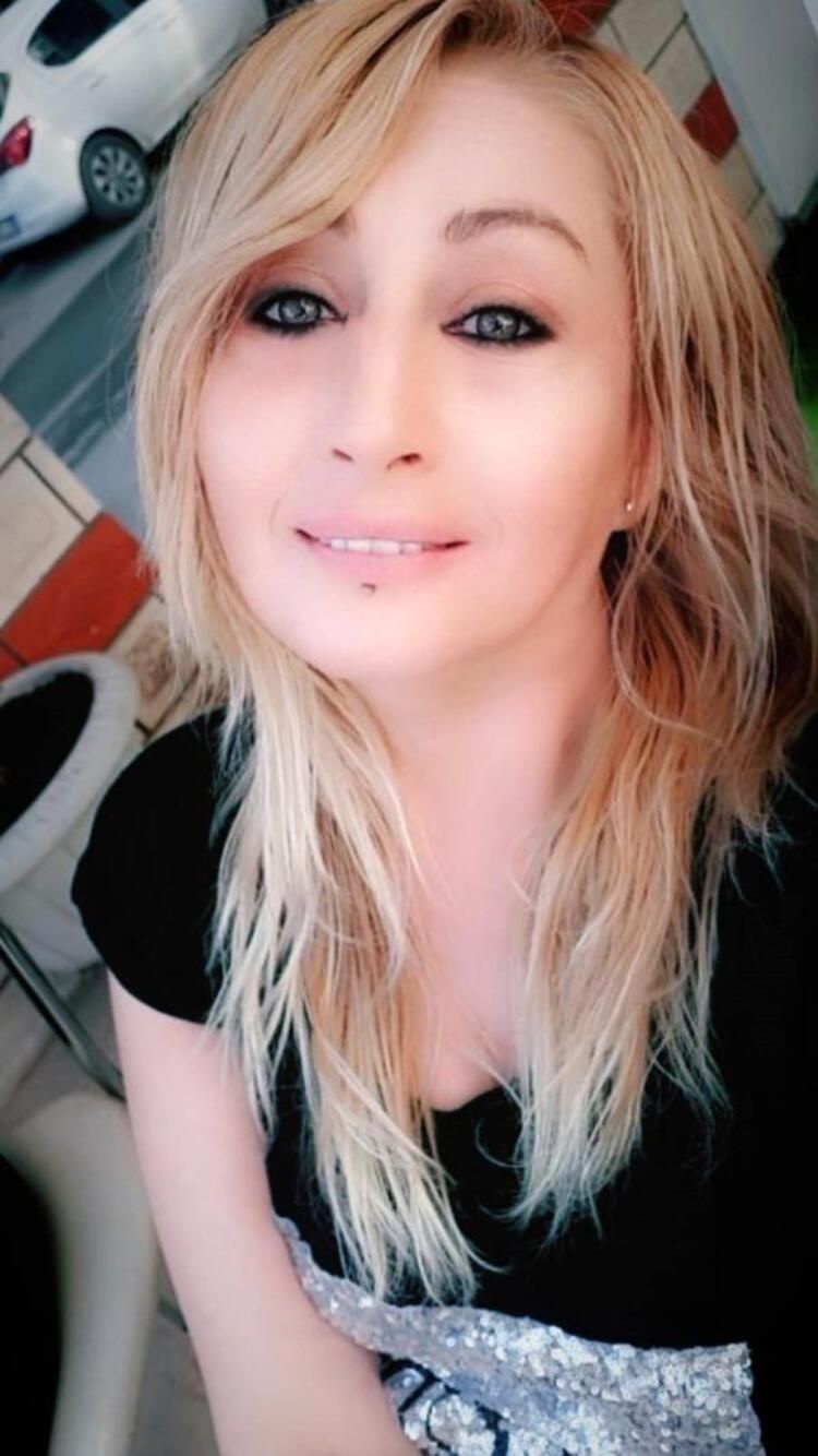Güzellik uğruna alt dudağını kaybetti! Kötü haber geldi... 7