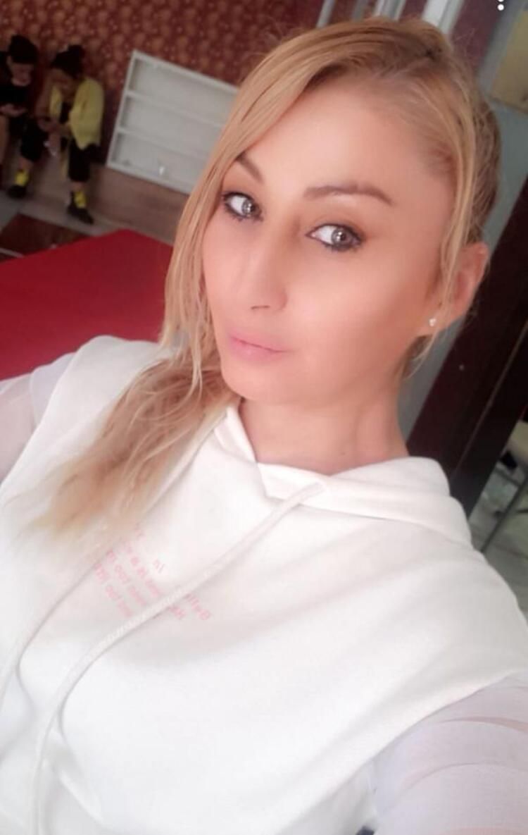 Güzellik uğruna alt dudağını kaybetti! Kötü haber geldi... 16