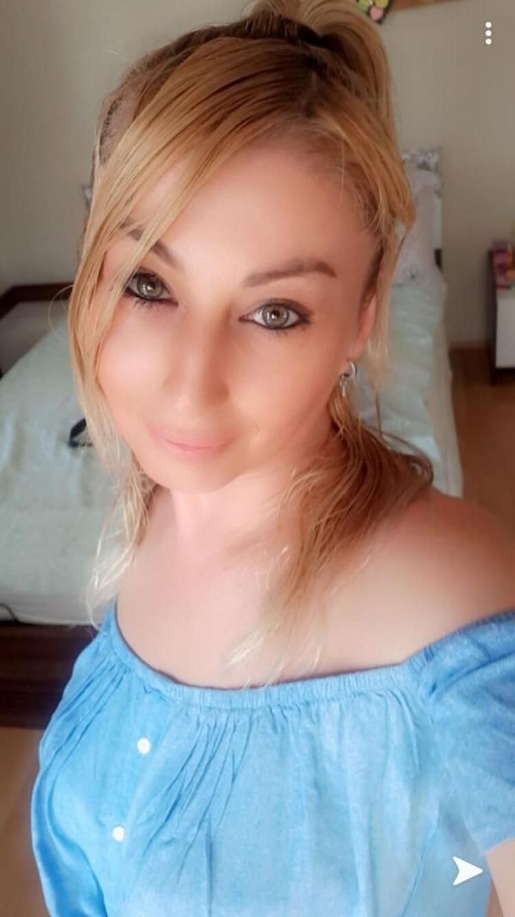 Güzellik uğruna alt dudağını kaybetti! Kötü haber geldi... 15