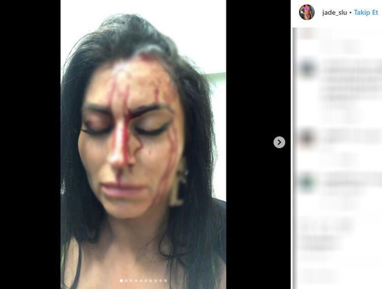 Eski güzellik kraliçesi dehşeti yaşadı! Her yeri kan içindeydi... 9
