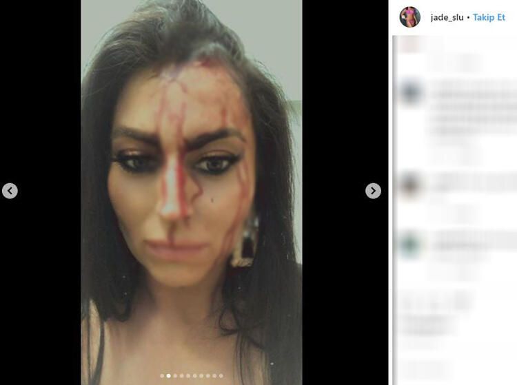 Eski güzellik kraliçesi dehşeti yaşadı! Her yeri kan içindeydi... 7