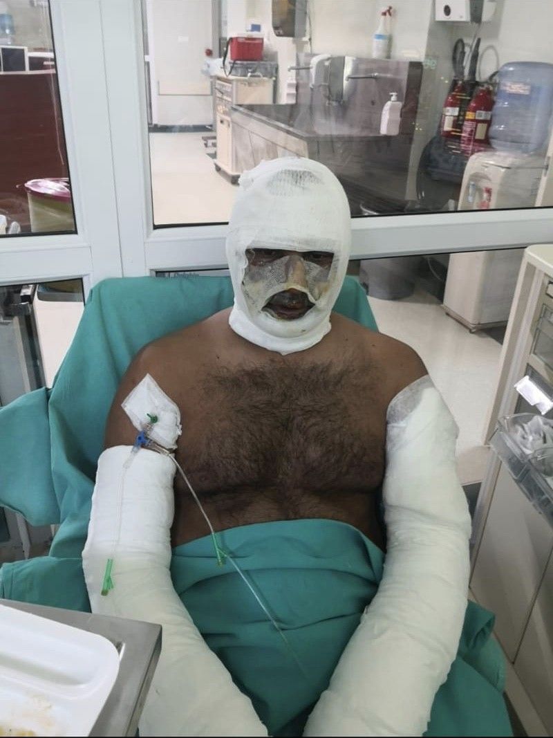 Şişli'de kebapçıda patlama! O anlar kamerada... 5