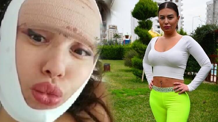Estetik tutkusunu dizginleyemiyor! 23. kez bıçak altına yatacak... 1