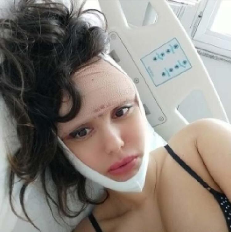 Estetik tutkusunu dizginleyemiyor! 23. kez bıçak altına yatacak... 10