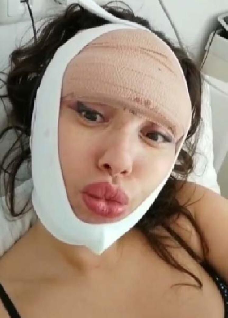 Estetik tutkusunu dizginleyemiyor! 23. kez bıçak altına yatacak... 11