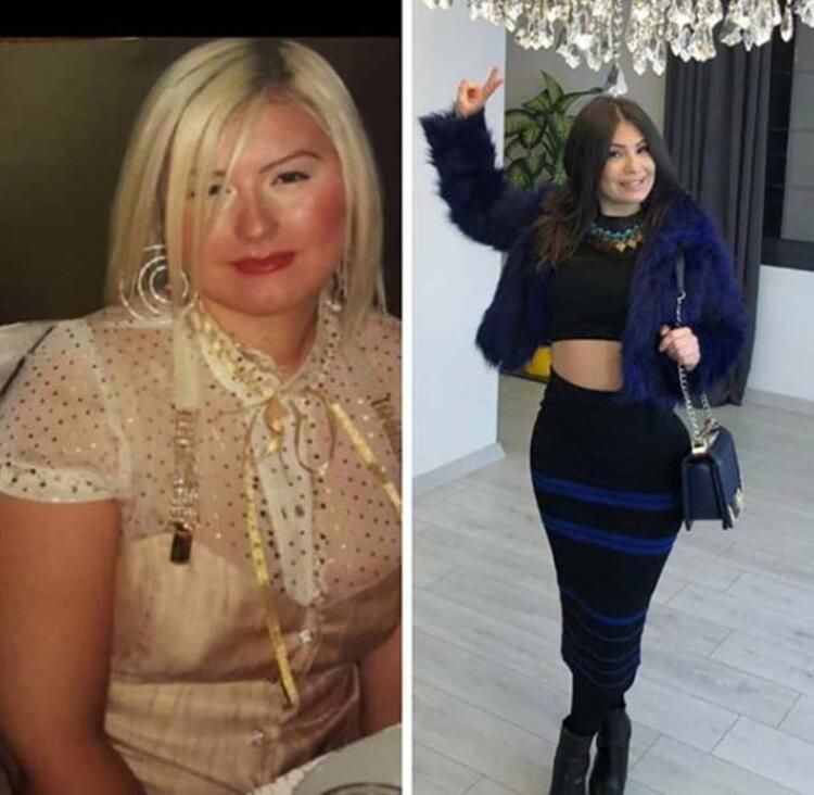 Estetik tutkusunu dizginleyemiyor! 23. kez bıçak altına yatacak... 3