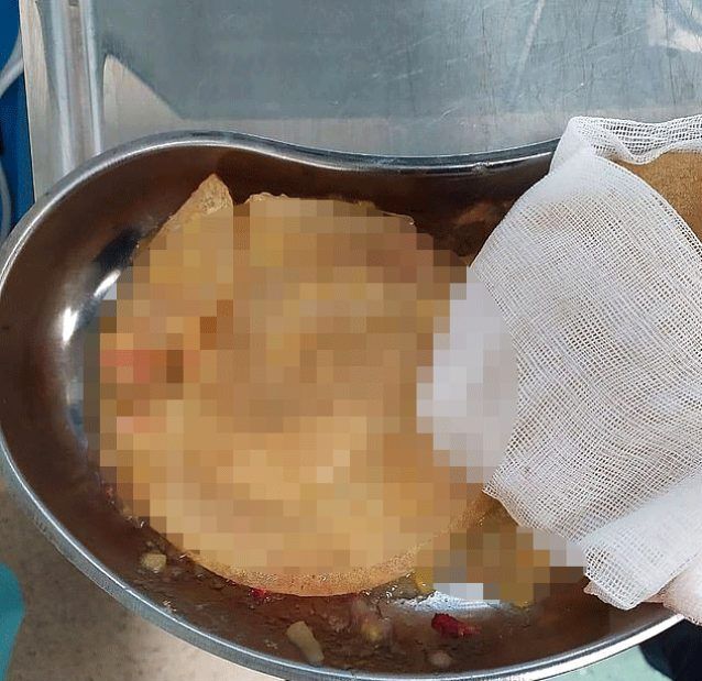 Ünlü spikerin göğüs silikonları patladı! 3