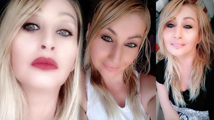 Güzellik uğruna dudağını kaybetmişti! Ağız içinden dudak yapılacak... 1