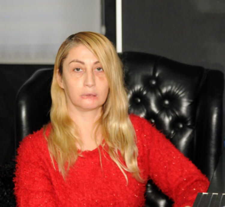 Güzellik uğruna dudağını kaybetmişti! Ağız içinden dudak yapılacak... 13